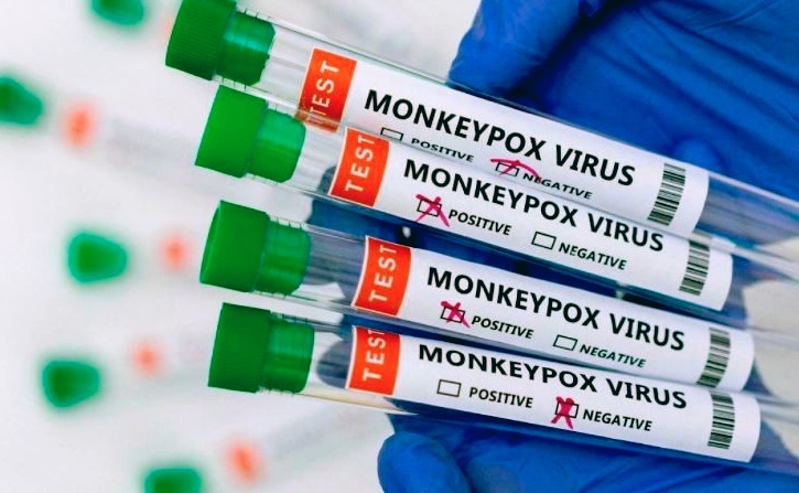 monkeypox virus - Symptoms, History, and Prevention Measures