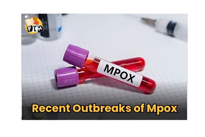 recent outbreak of mpox virus